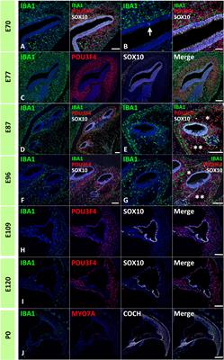 Distribution of macrophages in the developing cochlea of the common marmoset, a primate model animal